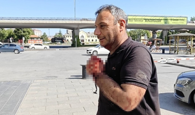 Kesim Kazaları: Kurban Bayramı’nda Yaralanmalar