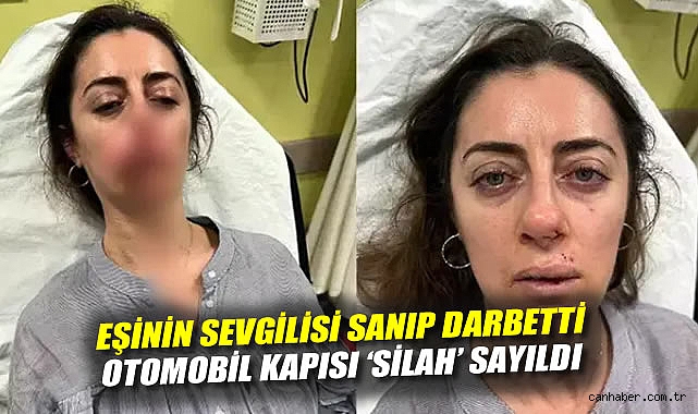 Araç kapısı ile yaralanan kadın, şüpheli serbest!